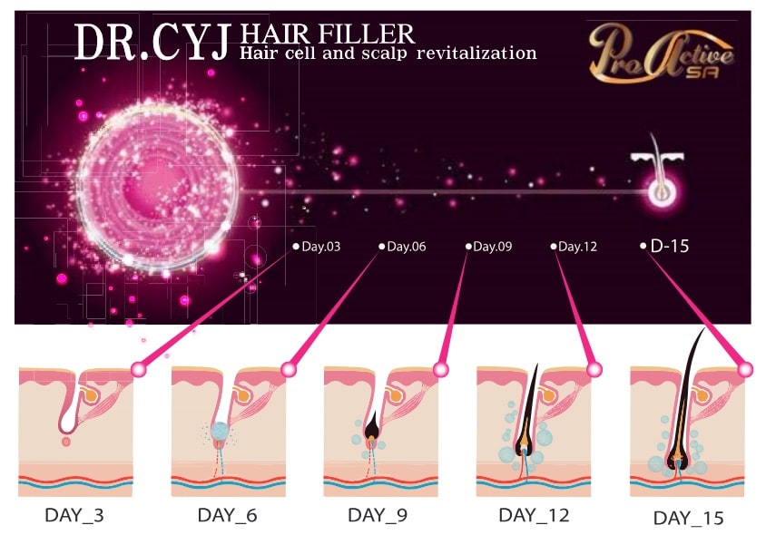DR CYJ Hair Filler graphic showing growth day 3, 6 9 12 and 15